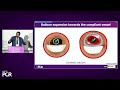 3DStent: a new era in stent enhancement - EuroPCR 2023