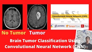 Brain Tumor Classification Using Convolutional Neural Network (CNN) - Training Accuracy