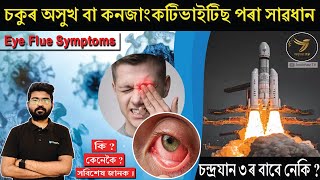 Eye Flu(চকুৰ অসুখ কি ?,কি কি সাৱধান অৱলম্বন কৰিব লাগে ? ),Symptoms,Treatment,Causes and Precautions.