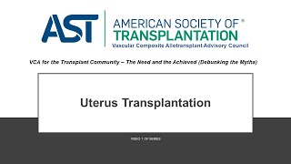 VCA for the Transplant Community – Debunking the Myths: Uterus Transplantation