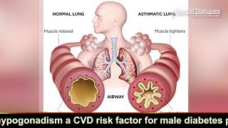 Prophylactic Azithromycin may reduce asthma