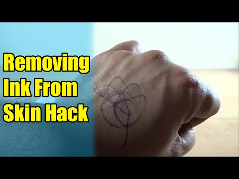 Removing Ink From Skin Hack - Works Really Fast!! Removing Ink From Skin Hack - Works Really Fast!!