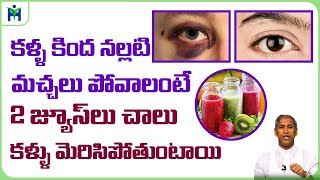 కళ్ళ కింద నల్లటి మచ్చలు పోయే బెస్ట్ టెక్నిక్ |Dr Manthena Satyanarayana Raju Videos|Health Mantra|