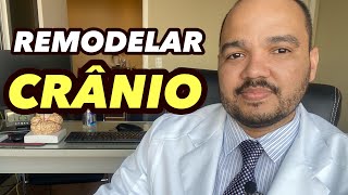 E possível remodelar o formato do crânio esteticamente? CRÂNIO NO ADULTO