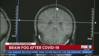 COVID-19 Patients Report Brain Fog Months After Diagnosis