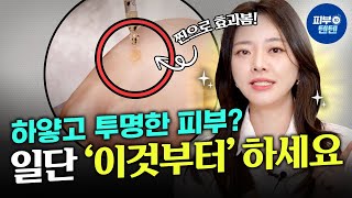 (광고❌) 피부과의사가 선택한 피부 하얘지는 방법은!?😎 | 피부하얘지는방법 맑은피부 투명한피부 연예인피부 피부좋아지는방법 출산 후 피부관리 미백 미백화장품 피부과전문의