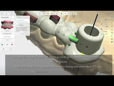 3Shape Unite Implant Studio 2022: Detailed Workflow - YouTube