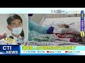 【每日必看】全台第2例mis c個案 男童反覆高燒7天 全身起疹 @中天新聞ctinews @健康 20220608