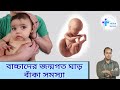 বাচ্চাদের ঘাঁড় একদিকে বাঁকা/ঘাড়ে টিউমার, ফোলা, শক্ত থাকলে কি করনীয়।Torticollis