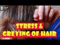 Stress and greying of hair | premature greying of hair causes, remedy