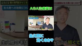 AGA治療薬は生え際に効くのか？＃Shorts