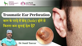 Traumatic ear Perforation | कान के परदे में छेद (hole) होने से कितना कम सुनाई देता है?