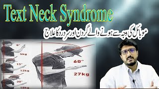 Neck pain and best posture for mobile use |text neck syndrome | neck pain by Dr.Mohsin Yousuf