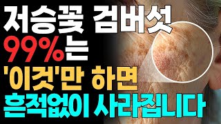 집에서 따라만 하면 검버섯 없애는 방법 3가지! 비싼 피부과 필요 없는 피부 건강 음식 TOP3ㅣ피부관리법ㅣ기미제거ㅣ검버섯제거