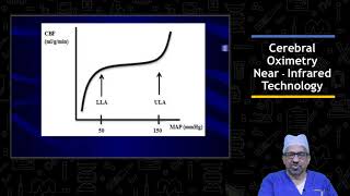 Cerebral Oximetry Dr Muralidhar Kanchi