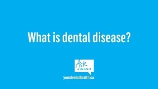 What is dental disease?