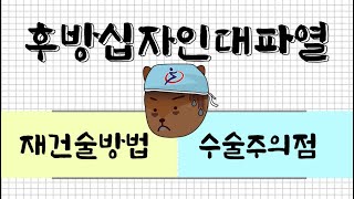 후방십자인대파열 시리즈 4 - 재건술방법, 수술주의점