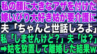 【スカッとする話】私の顔に大きなアザを付けた、嫁いびり大好き姑が要介護に。夫「ちゃんと世話しろよ」私「しませんけど？」夫「は？」➡︎姑を放置して離婚した結果w【修羅場】