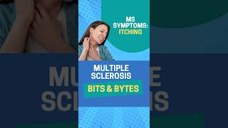 #MS and Numbness: From Buzzing to Burning! 🔥 #multiplesclerosis