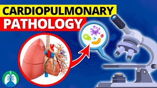 Cardiopulmonary Pathology | Heart and Lung Diseases