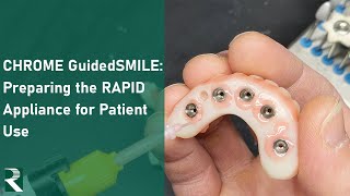 CHROME GuidedSMILE: Preparing the RAPID Appliance for Patient Use