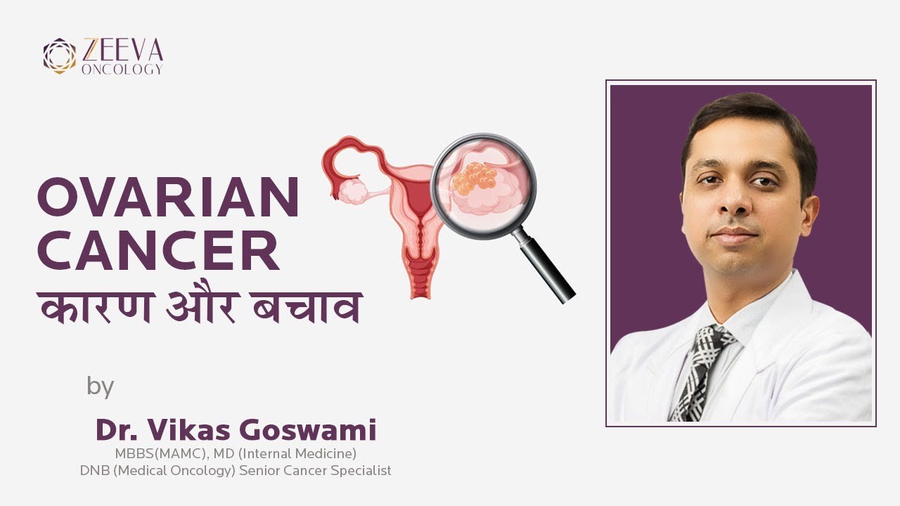 Ovarian Cancer: An Expert Overview | ओवेरियन कैंसर के लक्षण, कारण, इलाज ...