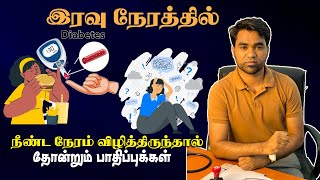 இரவு நேரத்தில் நீண்ட நேரம் விழித்திருந்தால் தோன்றும் பாதிப்புக்கள் | Impotance of night sleep