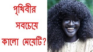 পৃথিবীর সবচেয়ে কালো মেয়েটির গল্প !