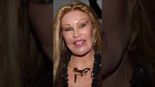 10 Worst Celebrity Plastic Surgery Fails That Shocked the World 😱 Part 1
