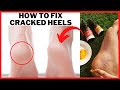 How To Fix CRACKED HEELS | How to Treat Cracked Heels at Home | Best Oils For CRACKED HEEL | #DIY