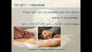 מדריך מלא ל דיקור סיני  -  Chinese medicine Full guide