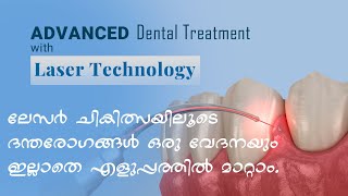 Confident Clean Quatro 4 Wavelength Dental Laser ലേസർ ചികിത്സയിലൂടെ ദന്തരോഗങ്ങൾ വേദന ഇല്ലാതെ മാറ്റാം