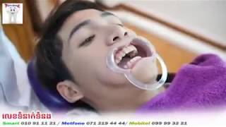 Tooth Smile Clinic | ការបិទធ្មេញអោយសរ # 1