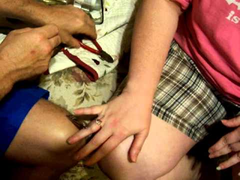 how to cut a ring off of your finger how to cut a ring off of your finger
