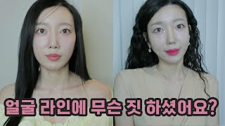 울쎄라 3개월 찐찐후기🫢 얼굴형 관리는 이걸로 끝입니다.. (땅콩 얼굴형 다 드루와..🔥)