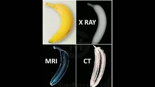 Difference between X ray CT Scan MRI #doctor #shortsfeed #short #shortsvideo