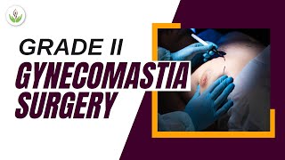 How Grade 2 Gynecomastia Surgery Can Help Restore Your Confidence? | Care Well Medical Centre