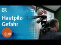 Hautpilz-Gefahr durch Trendfrisuren: Hygienemängel in Barbershops? | quer vom BR