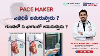 Pacemaker in Telugu || గుండె పేస్ మేకర్ అమర్చే విధానం || తీసుకోవల్సిన జాగ్రత్తలు.