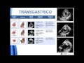 Guias para un examen de echocardiografia transesofagica integral