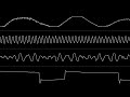 jogeir liljedahl “endless” amiga mod oscilloscope view