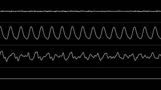 Jogeir Liljedahl - “Endless” (Amiga MOD) [Oscilloscope View]