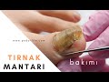 TIRNAK MANTARI BAKIMI / PODOLİFE AYAK SAĞLIĞI MERKEZİ