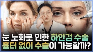 하안검 수술 vs 눈 밑 지방 재배치?! 하안검 수술의 궁금한점들 모두 모아서 알려드립니다!