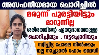 ചൊറിച്ചിലിനും വട്ടച്ചൊറിക്കും ഉത്തമ പരിഹാരം |ഫലപ്രദമായ ഹോം റെമഡി|FUNGUS|SKIN DESES|