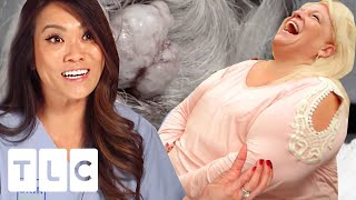 Woman Gets Her 35 Year Old Pilar Cyst Removed: It's Time For 'Big Bertha' To Go! | Dr. Pimple Popper
