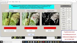 Bacterial Foraging Optimization Based Radial Basis Function Neural Network (BRBFNN) for