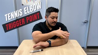 Tennis Elbow Trigger Point