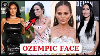 Top 15 Celebrities With SHOCKING Ozempic Face Transformations | Then and Now 2026