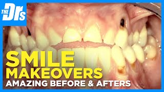 Jaw-Dropping Smile Makeovers on The Doctors